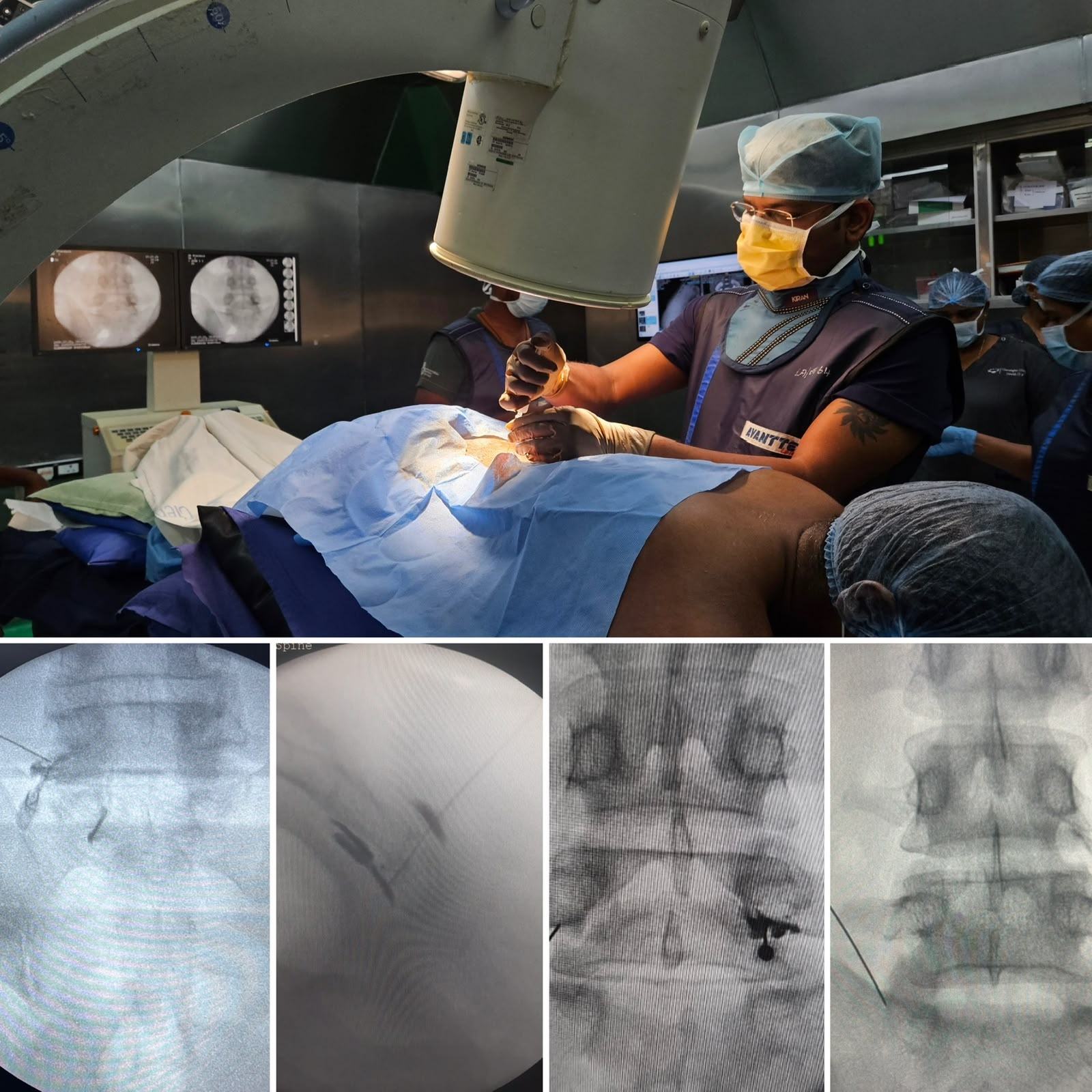 Robotic Spine Surgery