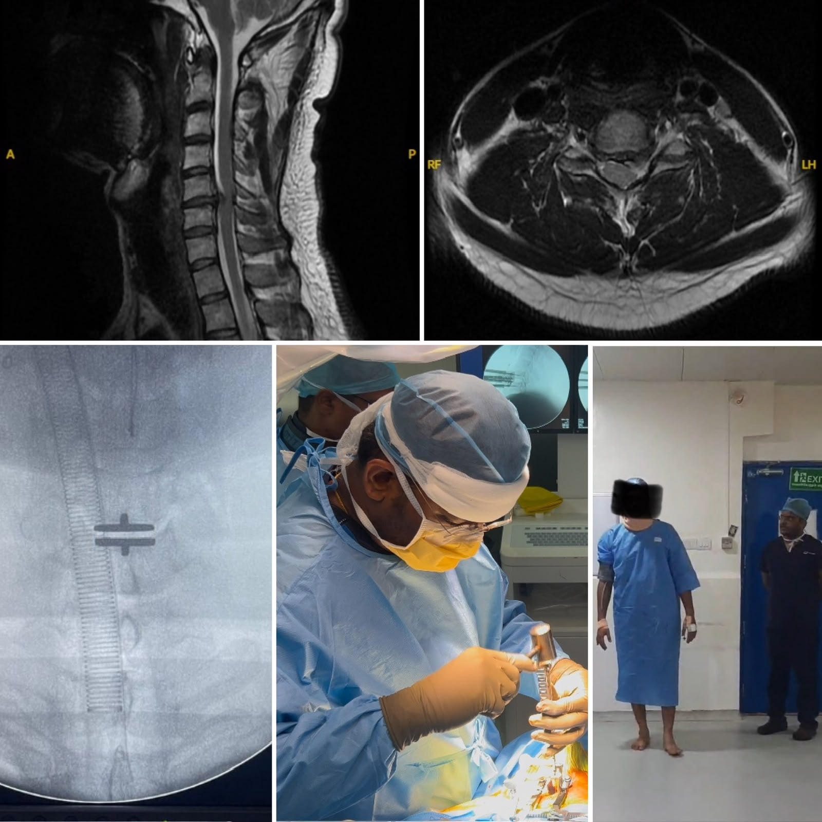 Image Guided Surgery