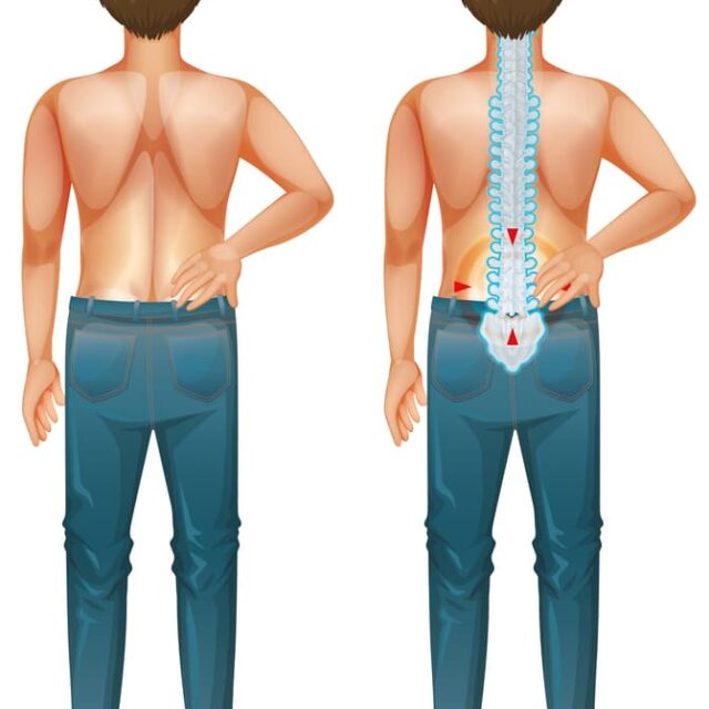 backpain https://drmdssasidharan.com/wp-content/uploads/2024/04/backpain-640x640.jpg