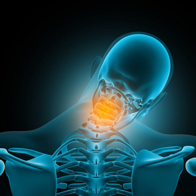 broken neck https://drmdssasidharan.com/wp-content/uploads/2024/04/broken-neck-640x640.jpg