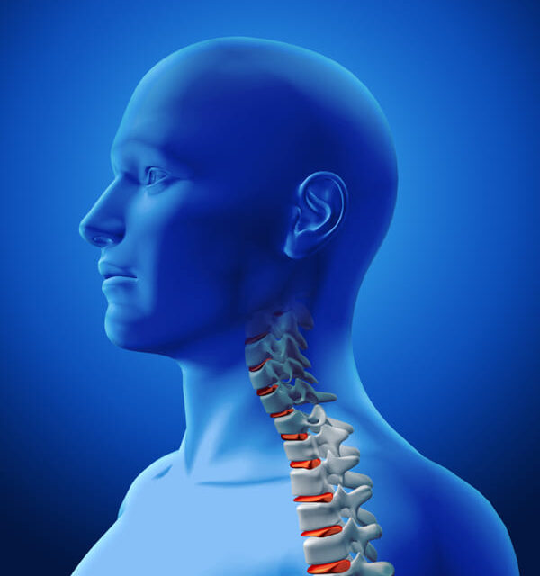https://drmdssasidharan.com/wp-content/uploads/2024/04/neck-stiffness-600x640.jpg